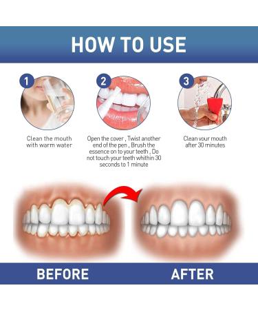 Attdx Rubber Immediate Treatment Gel & Tooth Whitening Pins - Fast Relief & Whitening Solution (2PCs) - Buy Online on GoSupps.com