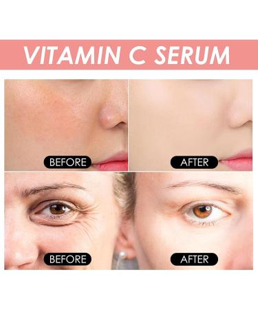 Vitamin C Hydrating Serum Vitamin C Serum For Face Reduce Aging Serum Skin Brightening Vitamin C Facial Serum For Women & Men Antioxidant Dark Spot Corrector Vit C Serum Hydrate & Brighten - Buy Online on GoSupps.com