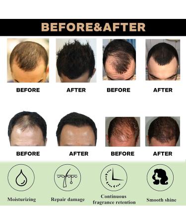 Hair Growth Spray Ginger Hair Growth Serum with Ginseng Hair Regrowth Essence for Men & Women Repairs Hair Follicles Moisturize Scalp and Promote Hair Growth Strengthen Hair Root - Buy Online on GoSupps.com