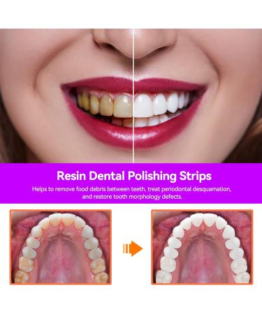 Dental Polishing Strips 50um - Teeth Abrasive Finishing Tool for Deep Cleaning - Oral Care - Buy Online on GoSupps.com