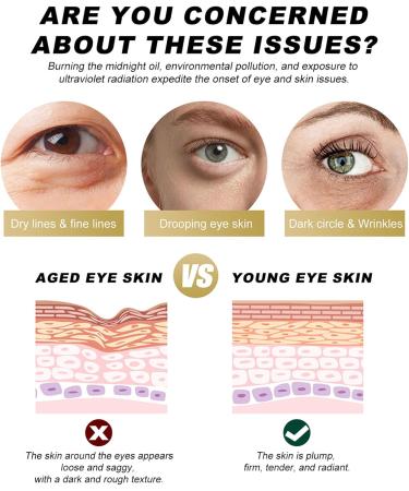 Retinol Eye Cream Eye Cream for Dark Circles and Puffy Eyes Eye Cream Anti Aging for Fade Dark Circles Under The Eyes and Moisturize Skin Anti Wrinkle Eye Cream for All Skin Types - Buy Online on GoSupps.com