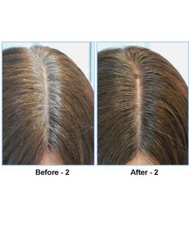Magical Fluffy Thin Hair Powder - Root Cover Up & Gray Coverage 4g (Carrot 03) - Buy Online on GoSupps.com