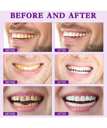 SP-7 Probiotic Lightening Toothpaste | Brightening Fresh Breath & Spot Removal - Buy Online on GoSupps.com
