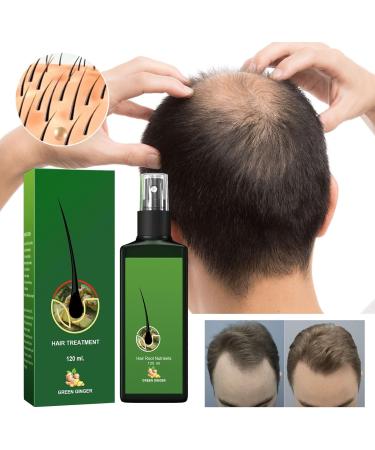 120ml Regrowth Nourishing Ginger Spray Serum Pousse Cheveux Spray Nourrissant Au Gingembre S rum de Croissance Capillaire au Gingembre pour le Traitement de la chute des Cheveux - Buy Online on GoSupps.com