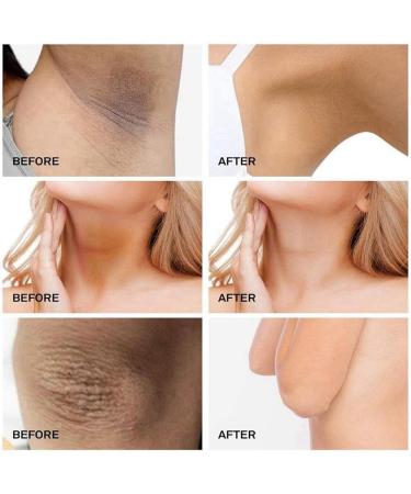 UnderarmCream For Dark Skin And Private Parts Armpit Lightening Cream Body Cream Dark Armpit Treatment Skin Lightening Cream Armpit Brightienng Body Brightening Cream For Dark Skin - Buy Online on GoSupps.com