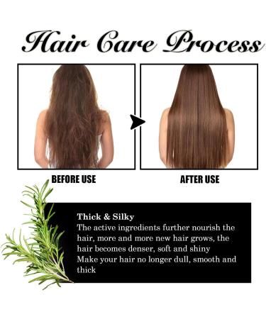 Odavom Rosemary & Mint Hair Oil - Moisturizing Solution for Fine Hair & Hair Loss | Perfect for Home & Travel - Buy Online on GoSupps.com