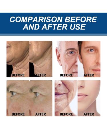Mikabila 50ML Anti-Wrinkle Face Cream for Man Pro-Collagen Anti-Wrinkle Moisturiser for Men Anti-Ageing Mens Repair Skincare Natural and Organic Anti Wrinkle Face Cream To Reduce Fine Lines - Buy Online on GoSupps.com