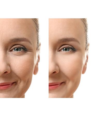 Buy Wrinkle Eraser Night Cream - Zion Health 1 oz | Best Anti-Aging Cream for Youthful Skin - International Shipping Available - Buy Online on GoSupps.com