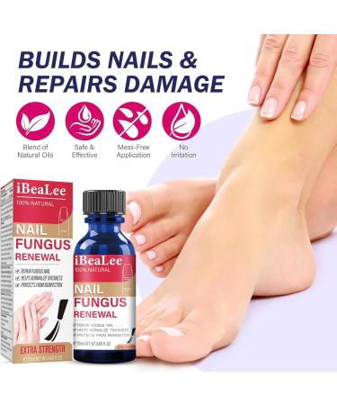 Fungal Nail Treatment - Nail Fungus Treatment For Toenail - Extra Strong Toe Nail Fungal Treatment - Anti fungus Nail Repair and Strengthen Fix & Renew Damaged Broken Nails - Buy Online on GoSupps.com
