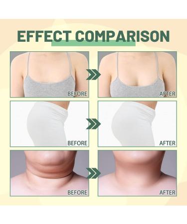 Body Shaping Essential Oil for Women Collagen Lifting Body Oil Fat and Calorie Blocking Serum Skin Tightening Firming Serum Oil - Buy Online on GoSupps.com