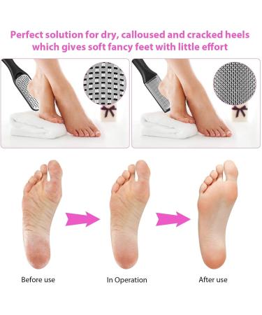 AdamStar 23 in 1 Professional Pedicure Kit - Foot Care Tools Set for Men and Women | Callus Remover, Toenail Clipper, Foot Scrubber, Foot Rasp, Dead Skin Remover - Home Salon Quality - Buy Online on GoSupps.com