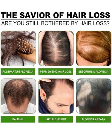 Solution de repousse capillaire par micro-aiguilles s rum de croissance capillaire par micro-aiguilles pointes fourchues lisses frisottis r duits force et paisseur 1pcs - Buy Online on GoSupps.com