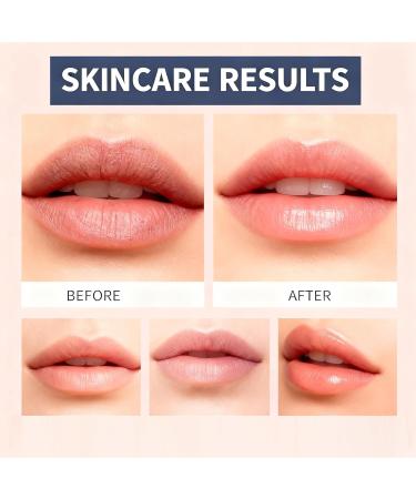  XUSHAOLUN Multi-volume calcium neck balm anti-aging firming treatment stick wrinkle and firming cream multi-collagen balm calcium collagen wand lip skin (8PCS) - Buy Online on GoSupps.com