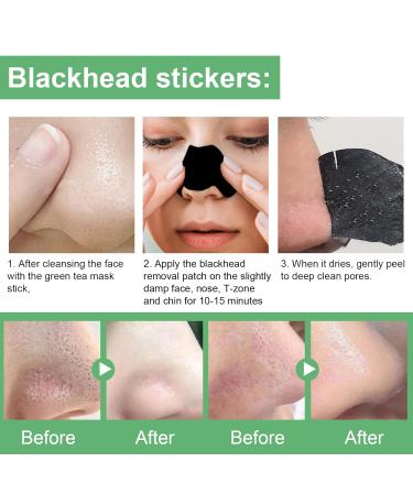 OEWWEX Green Tea Clay Stick & Pore Strips Combo Pack - 10 PC Blackhead & Acne Remover Patches for Deep Pore Cleansing - Men and Women's Skin Care - Buy Online on GoSupps.com