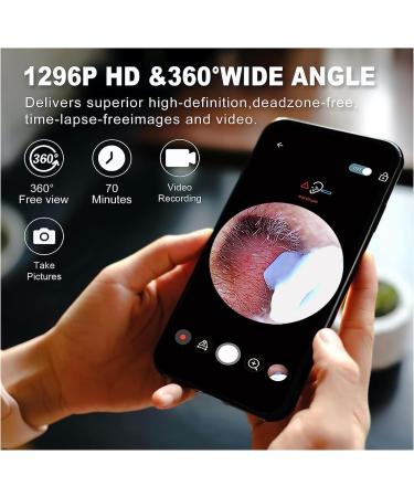 1296P Ear Wax Removal Tool Camera - Ear Cleaner with Light and Camera, 8pcs Ear Set, Compatible with iPhones, iPad, Android - Earwax Removal Kit - Buy Online on GoSupps.com