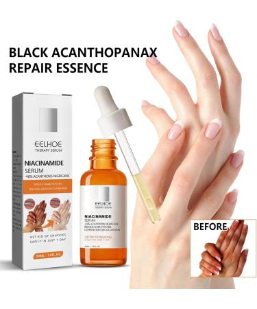 Niacinamide Serum Serum B5 Vitamin B3 Serum Anti-Wrinkle Serum for a Radiant Skin Tone and Minimised Pores Against the First Signs of Skin Ageing - Buy Online on GoSupps.com