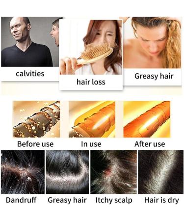 Imtrub Solipour Hair Shampoo - Natural Ginger Hair Regrowth Shampoo Nourishing Shampoo Portable Effective Anti-Hair Loss Shampoo for Hair - Buy Online on GoSupps.com