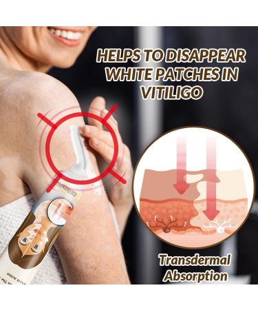  MagiSel Cream to repair white spots and pigmentation disorders hypoallergenic skin cream and pigment gel for skin with white spot disease promotes an even skin tone. - Buy Online on GoSupps.com