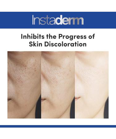 Best Anti Aging Dark Spot Corrector Serum - Reduce Dark Spots Sun Spots & Acne Scars | Rejuvenate Skin Tone & Texture - Buy Online on GoSupps.com