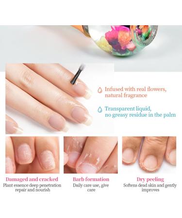 Nail & Cuticle Oil for Nails Moisturizing Cuticle Oil With Natural Flower Nail Oil Cuticle Natural Revitalizer for Moisturize Dry Nails & Cuticles Care Nail Hardener Cuticle Remover - Buy Online on GoSupps.com