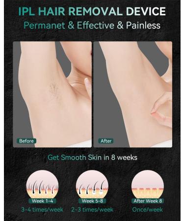 JOVS X IPL Hair Removal Device - Permanent 3-in-1 System with Cooling, Touch Screen, Unlimited Flashes - At-Home Painless Remover for Women and Men - Face, Leg, Arm, Armpit, Bikini Line - Emerald - Buy Online on GoSupps.com