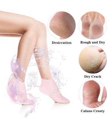 Yolev 2 Pairs Silicone Moisturizing Foot Socks Soft Silicone Socks Anti Slip Gel Spa Socks Women Foot Care Spa Pedicure Silicone Socks for Cracked Heel and Softening Rough Skin Calluses - Buy Online on GoSupps.com