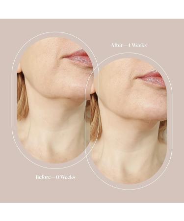 Trophy Skin Labelle Skin Spatula - Deep Clean Exfoliation and Infusion Tool - Buy Online on GoSupps.com