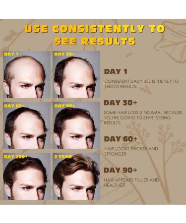 SALUBRITO 5% Biotin Minoxidil Hair Growth Oil 120ML - Hair Loss Treatment for Men & Women - Thickening & Regrowth Serum - Two Months Supply - Buy Online on GoSupps.com