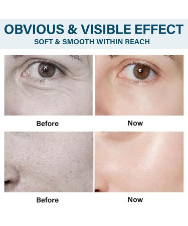 Hyaluronic Acid Powder Pure DIY Serum Formula for Face & Skin Deep Hydration & Wrinkle Reduction 3.52Oz 1qs - Buy Online on GoSupps.com