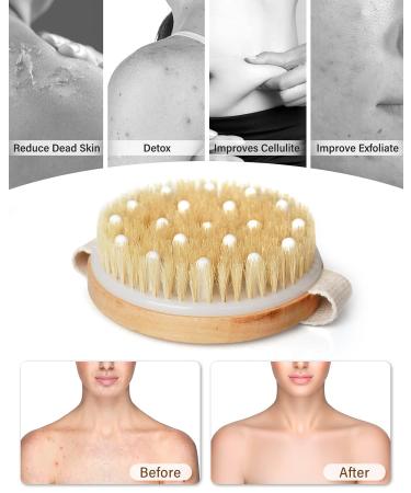 POPCHOSE Dry Brush Exfoliator for Smooth Skin, Cellulite Reduction, and Lymphatic Drainage | Natural Bristles for Blood Circulation Boost - Buy Online on GoSupps.com