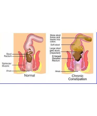 The One Minute Miracle Oxy-Colon Cleanse Vegan Colon Cleanser - 120 Vegatarian Capsules. - Buy Online on GoSupps.com