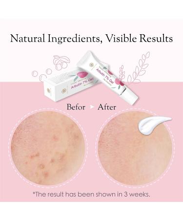 7% Alpha Arbutin - Premium Dark Spot Remover for Flawless Skin | International Shipping - Buy Online on GoSupps.com