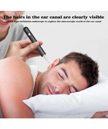 TopQuaFocus Earwax Removal Kit - Electric Otoscope with 6 LED Lights & 1000P HD Camera | Wireless Ear Scope for Kids & Adults | Easy Ear Cleaning & Pediatric Wax Remover - Buy Online on GoSupps.com