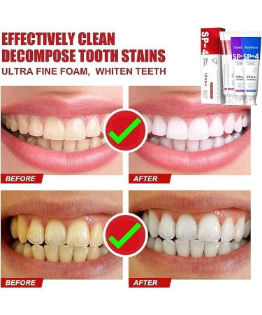 Yayashi SP-4 Toothpaste & Ksndurn Whitening Toothpaste 120g - Freshens Breath Whitens Teeth Removes Stains - International Shipping Available - Buy Online on GoSupps.com