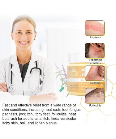 Manuka Honey Cream for Eczema, Psoriasis, Tinea Versicolor & More - 4 fl oz | Fast Acting Relief for Skin Conditions | Adults & Kids - Buy Online on GoSupps.com