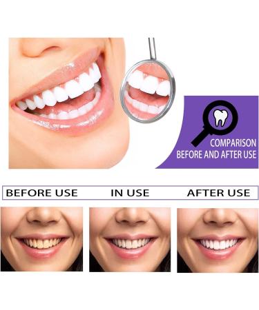 Xinyun Mild Whitening Toothpaste | Purple Tooth Color Correction & Fresh Breath | 30ml Tooth Bleach & Cleaning Solution - Buy Online on GoSupps.com