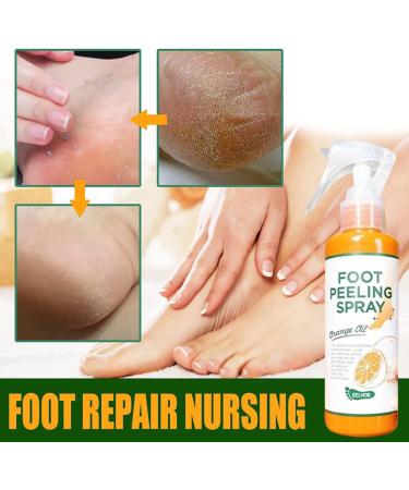Foot Peeling Spray Orange Oil Foot Peeling Spray That Remove Dead Skin Tea Tree Foot Peeling Spray Remove Dead Skin within Seconds Exfoliator For Cracked Rough Heels Dry Toe Skin&Calluses (Orange) - Buy Online on GoSupps.com