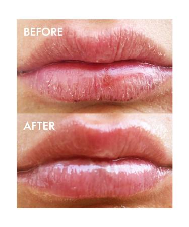 Lanolips 101 Ointment Superbalm Duo - Multipurpose Natural Healing Moisturizer for Lips, Skin, and Cuticles - Fragrance-Free - 2x15g - Buy Online on GoSupps.com