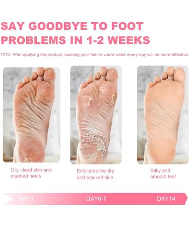 2 Pairs Foot Peel Mask for Soft Baby-Soft Feet | Exfoliating & Moisturizing Callus Remover Treatment Socks with Plant Formula | Rose Scented - Buy Online on GoSupps.com