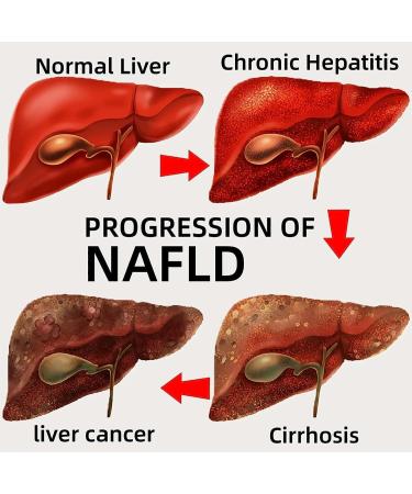 DENERASS TinaHerbs PRO Milk Thistle & Cordyceps Sinensis Drops - Liver Support Detox & Repair - Herbal Drops Trio - Buy Online on GoSupps.com