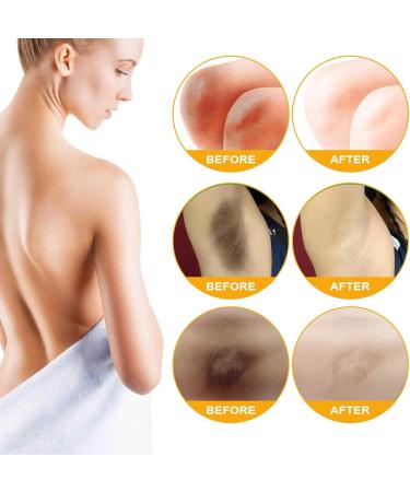  Generisch Body cream non-greasy skin lotion moisturizing body lotion for daily and night use all over the body - Buy Online on GoSupps.com