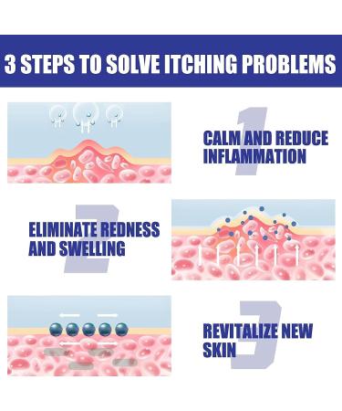 SHEDIAO South Moon Psoriasis Relief Spray - Herbal Treatment for Skin Plaque Psoriasis (5PCS) - Buy Online on GoSupps.com