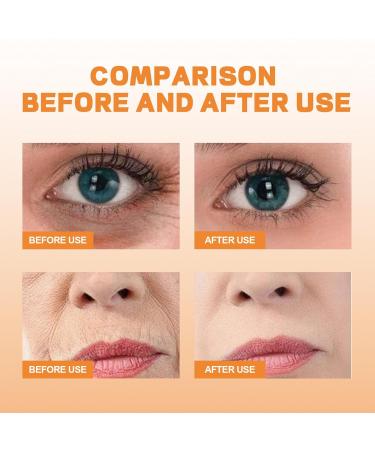 Yidkx Korean Soluble Collagen Film Set | Highprime Collagen Mask & Mist for Radiant Skin (1 Set) - Shop Internationally - Buy Online on GoSupps.com