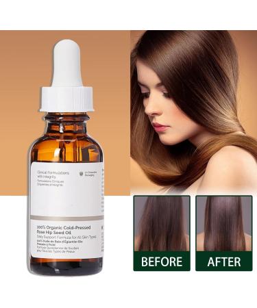100% Organic Rose Seed Oil Rosehip Oil for Face Rose Essential Oil Body Oil for Women Anti Aging Serum for Face Organic Rosehip Oil Rose Hip Oil for Skin Rosehip Seed Oil for Face Skin Hair Nails - Buy Online on GoSupps.com