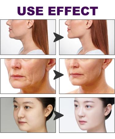 Facial Lifting Tape Reduce Double Chin Wrinkle Removal V Shape Instant Face Lifting Sticker for Firming and Rejuvenating Skincare Needs - Buy Online on GoSupps.com