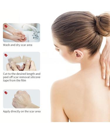 Sanfe Elephant Silicone Scar Sheets Roll - Professional Reusable Scar Tape for C-section Surgery, Burns, Keloids, Acne - 1.2 x 39 Roll-1M - Buy Online on GoSupps.com