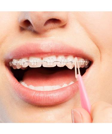 JMU Orthodontic Elastics 5/16 Inch Medium 4.5oz 500 Pack - Latex Free Dental Rubber Bands - Made in USA - Buy Online on GoSupps.com