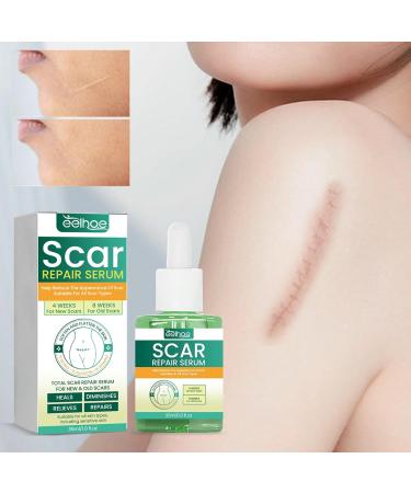 PARWENE ScarRevita Advanced Repair Serum - Effective Scar Removal Spray for All Skin Types (3pcs) - Buy Online on GoSupps.com