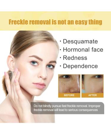 Kasumi Abera Whitening Cream - Japanese Premium Face Cream for Dark Spot Reduction | Suitable for All Skin Types | 1PCS - Buy Online on GoSupps.com