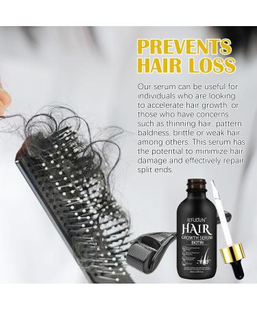 Hair Growth Oil with 5% Biotin - Nourishes Scalp and Stops Hair Loss - Promotes Stronger Thicker Hair for Men and Women Hair Regrowth Treatments with 0.25mm Roller (60ml) - Buy Online on GoSupps.com